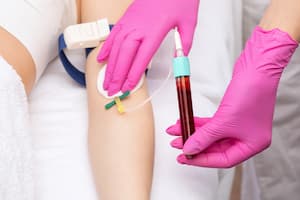 Platelet-rich plasma Orthobiologic injection 